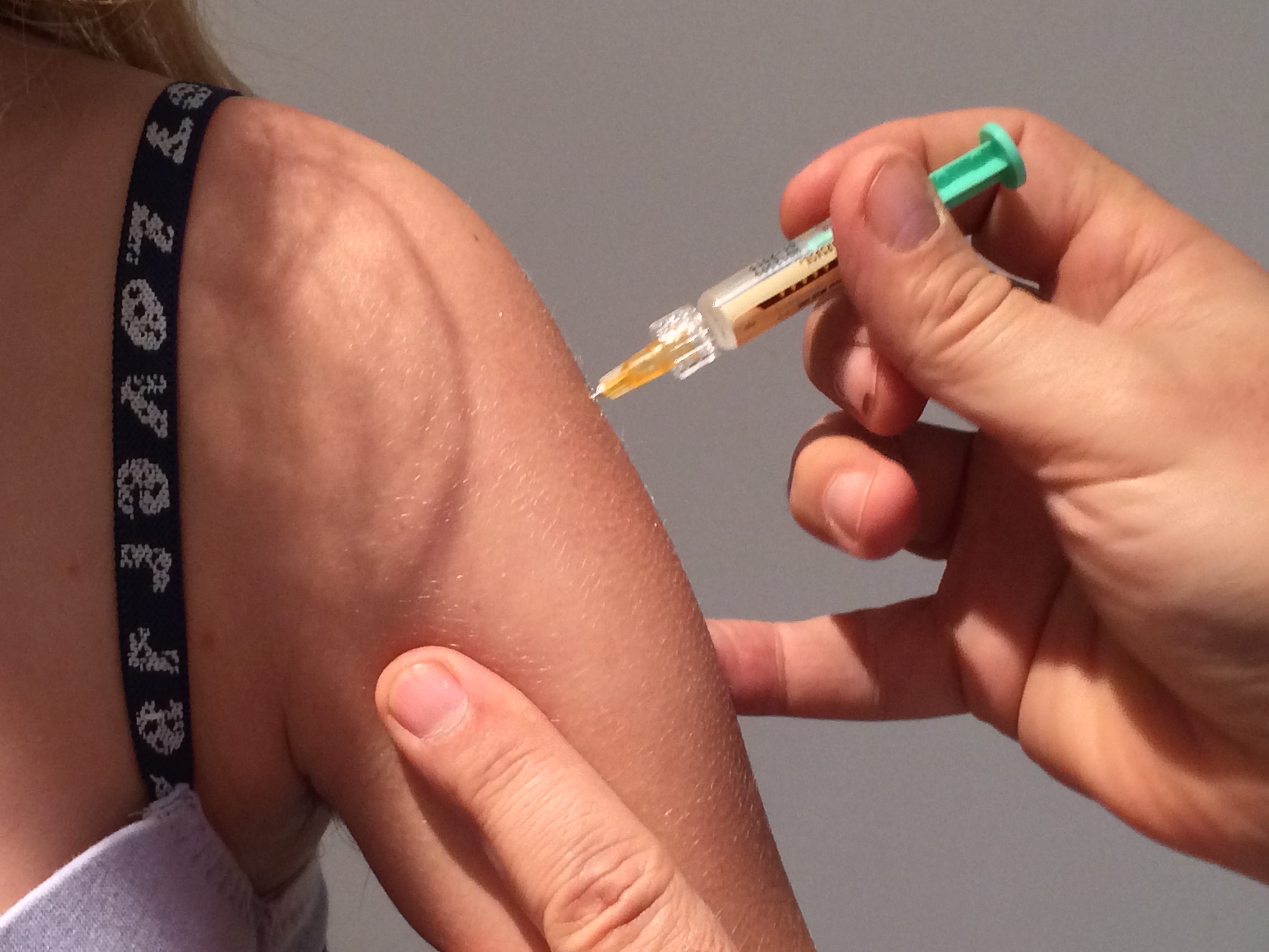 La question du jour : Gardasil 4 puis Gardasil 9